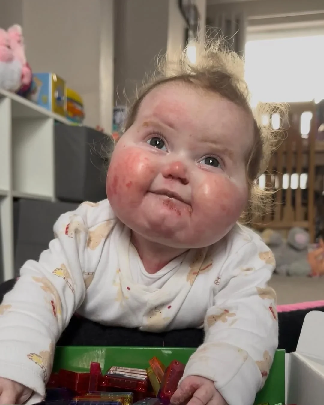 Vivi brincando apesar das feridas no rosto