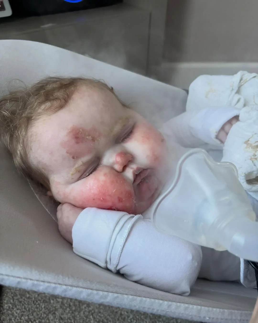 Vivi em casa, no colo, durante o cuidado diário